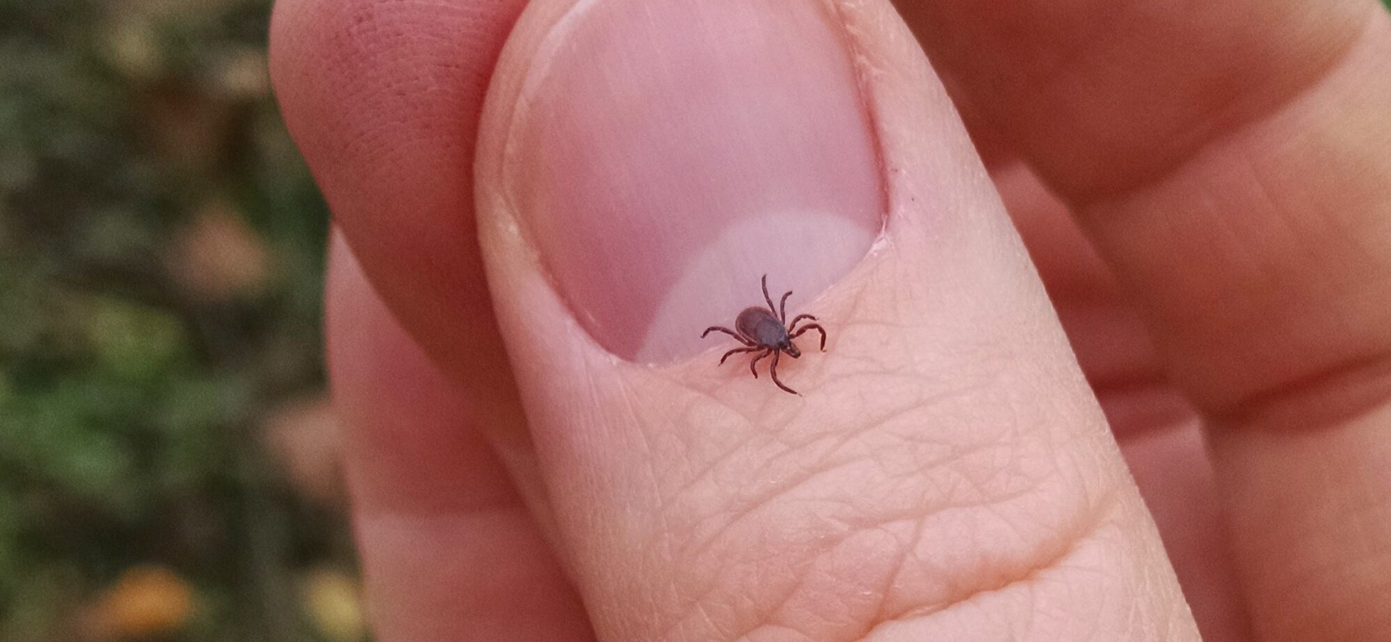 Close-up image of a tick on a human hand, demonstrating the need for reliable pest control services from Pest Me Off.
